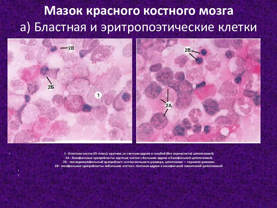 Единичные увеличенные ядра плоского. Мазок красного костного мозга препарат гистология. Срез красного костного мозга гематоксилин эозин. Основные структурные элементы красного костного мозга. Ретикулярные клетки красного костного мозга.