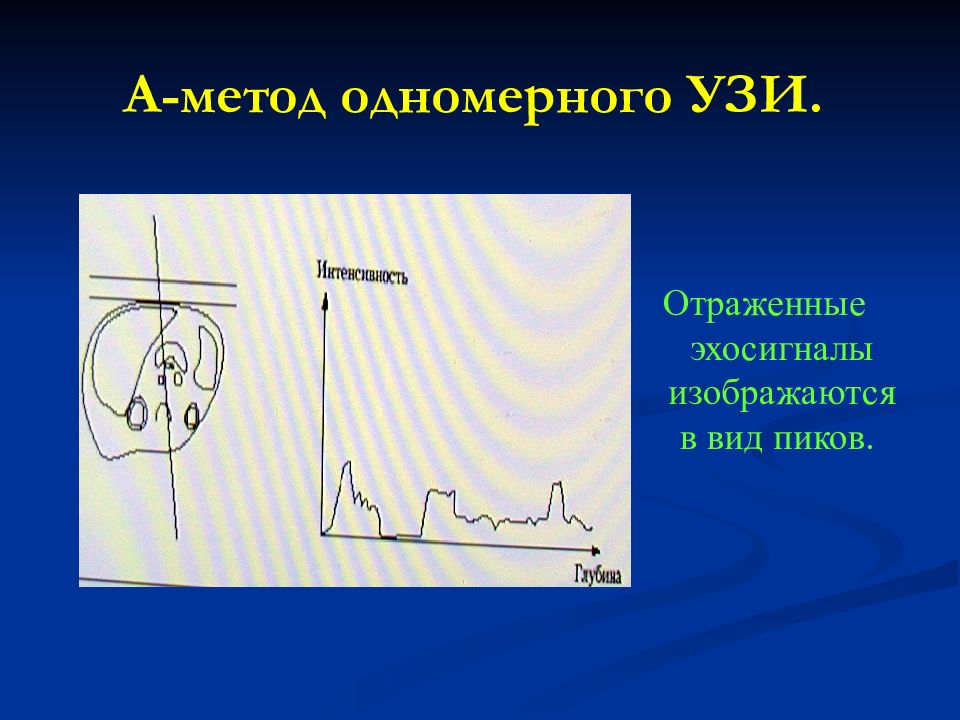 Способ м. Одномерный метод ультразвукового исследования. Эхография одномерная а метод. Методики ультразвукового исследования a-режим. Одномерный метод УЗИ.