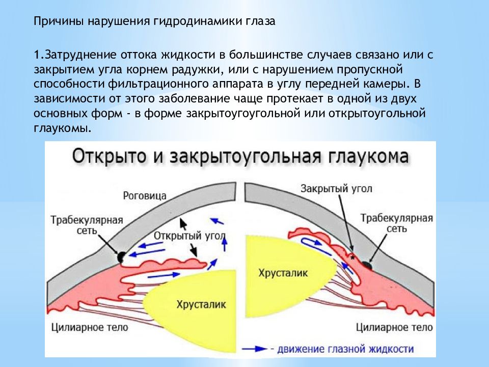 Почему нарушение. Нарушение гидродинамики глаза глаукома. Гидродинамика глаза пути оттока. Причины, приводящие к нарушению гидродинамики глаза. Схема оттока внутриглазной жидкости.