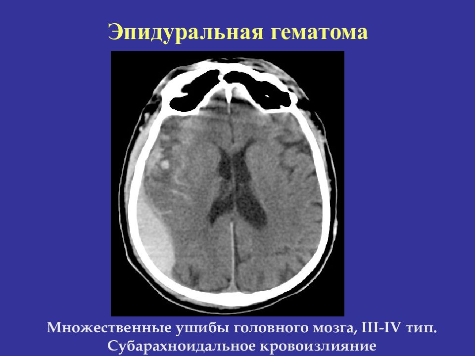 Лучевая диагностика головного мозга презентация