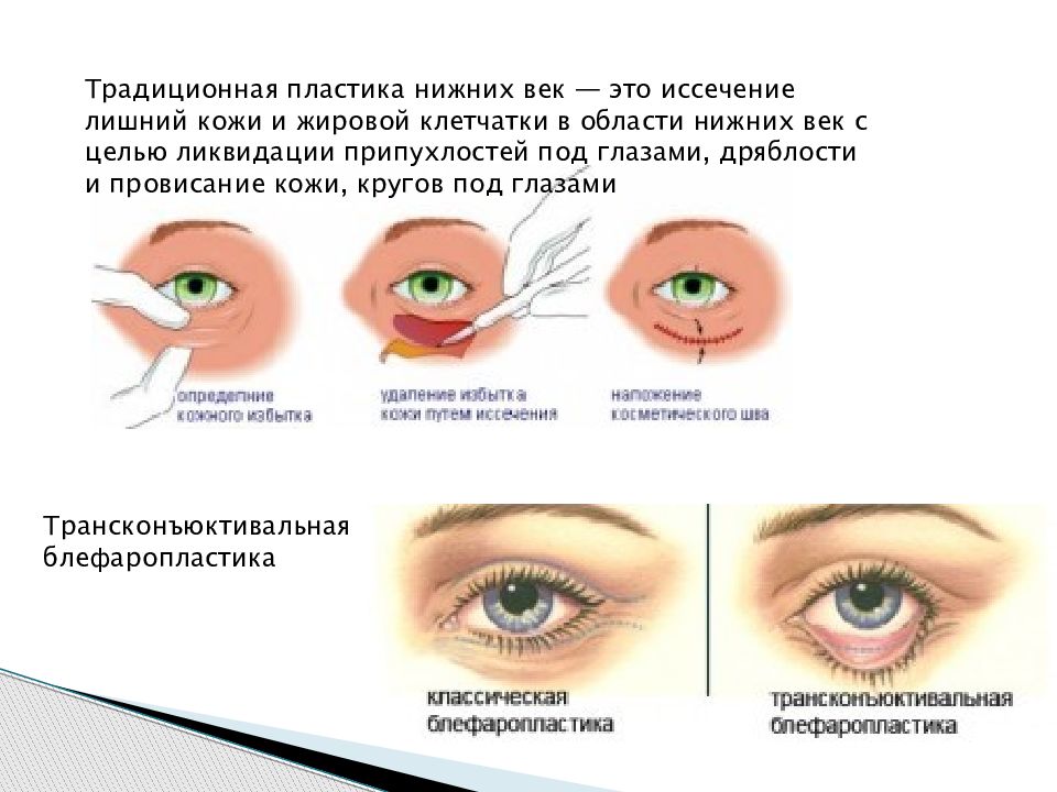 Пластическая хирургия презентация