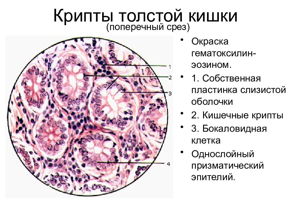 Клетка толстая. Крипты толстой кишки гистология. Крипты Толстого кишечника гистология. Слизистая оболочка толстой кишки. Окраска гематоксилином и эозином. Поперечный срез тонкой кишки гистология.