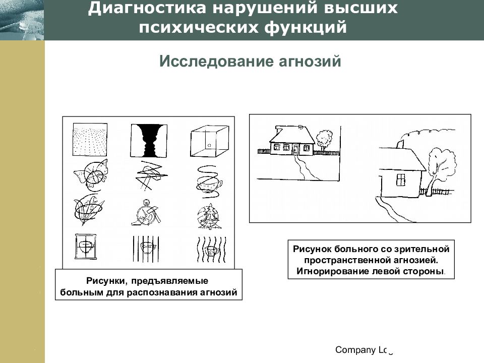 1 схему рисунок отражающие нарушения зрительного внимания игнорировании какой либо стороны