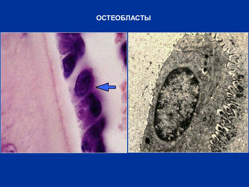 Остеокласты и остеобласты картинки