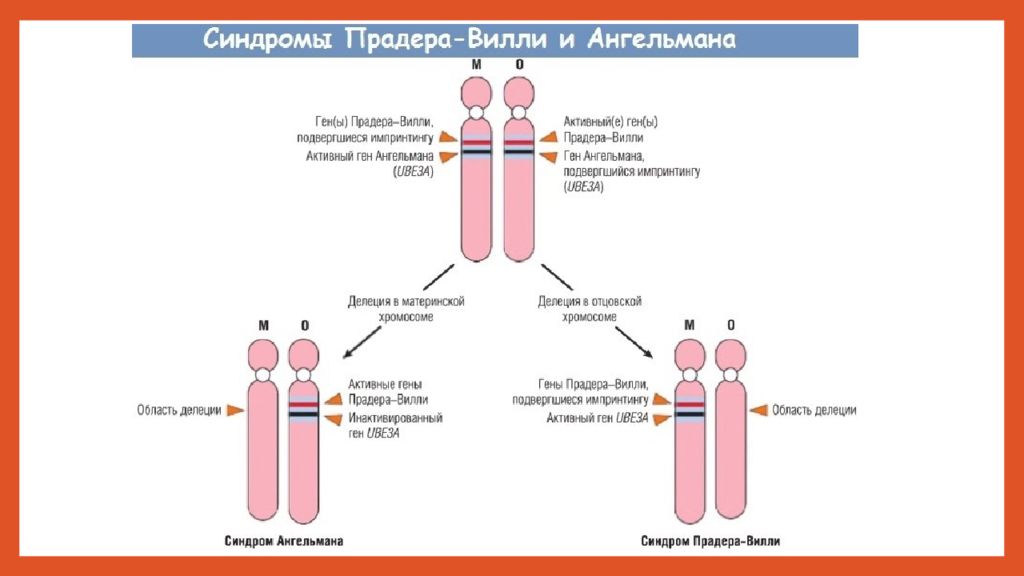 Синдром прадера вилли презентация