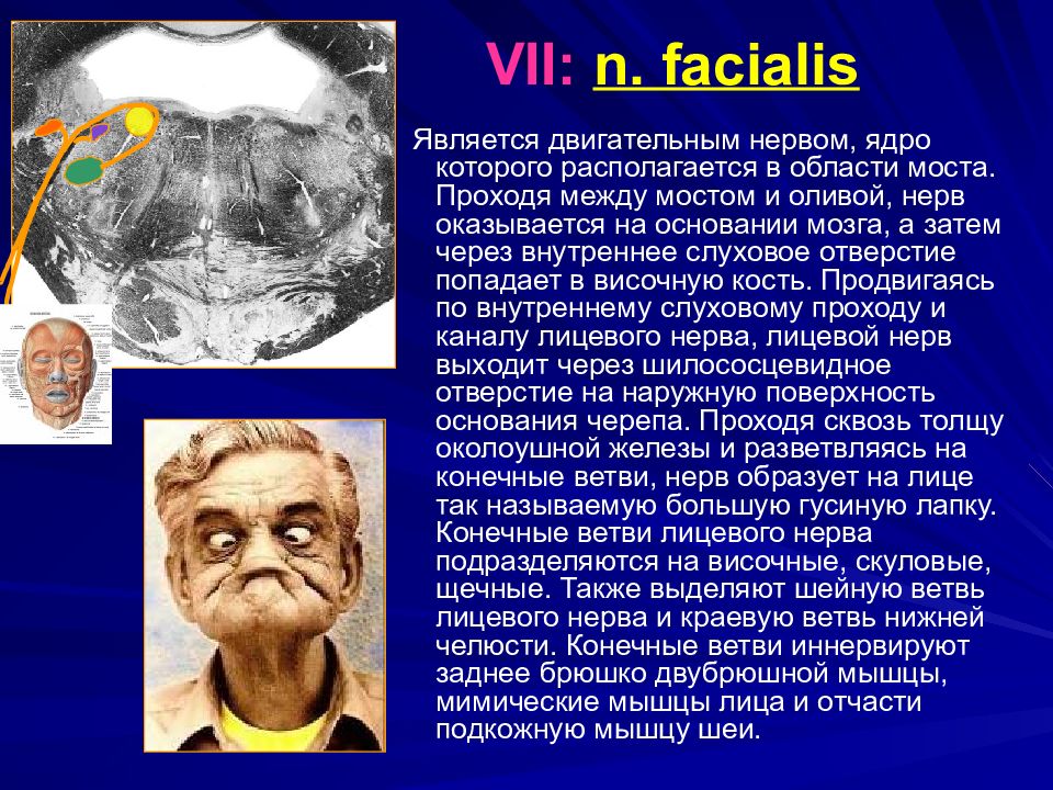 Двигательным является нерв. N Facialis. Ядро нижней оливы является двигательным.