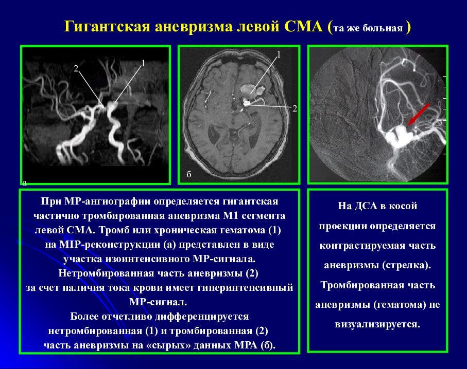 Лучевая диагностика головного мозга презентация