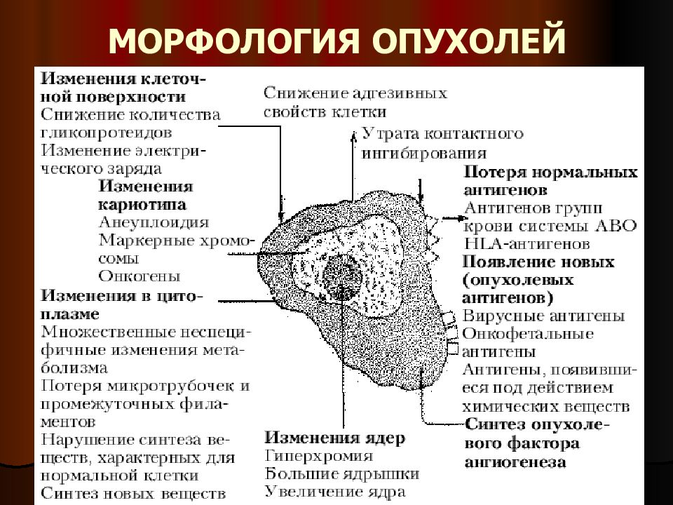 Признаки роста опухоли. Строение злокачественной опухоли. Микроскопическое строение опухоли. Морфология доброкачественной опухоли. Строение раковых опухолей.