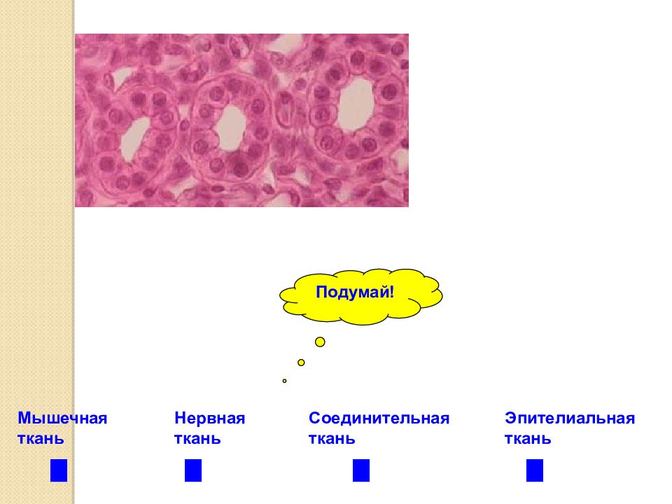 Какая ткань изображена на рисунке эпителиальная мышечная соединительная нервная