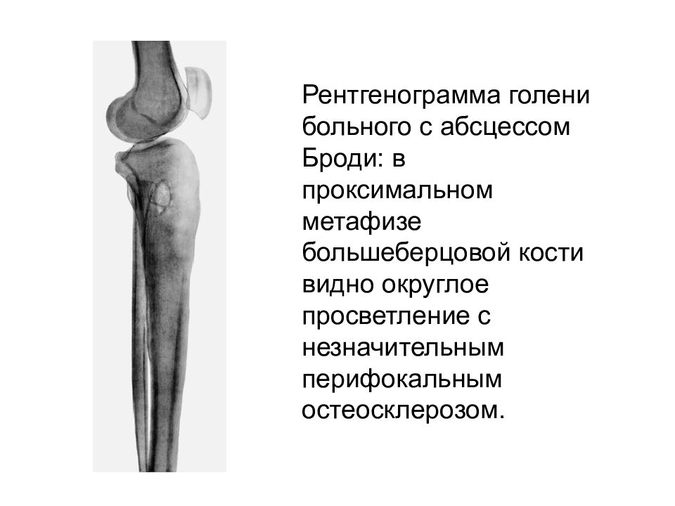 Проксимальный отдел большеберцовой кости фото