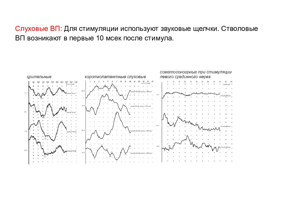 Регистрация слуховых вызванных потенциалов. Слуховые вызванные потенциалы. Слуховые вызванные потенциалы заключение. Слуховые ВП. Анализ активности мозга.