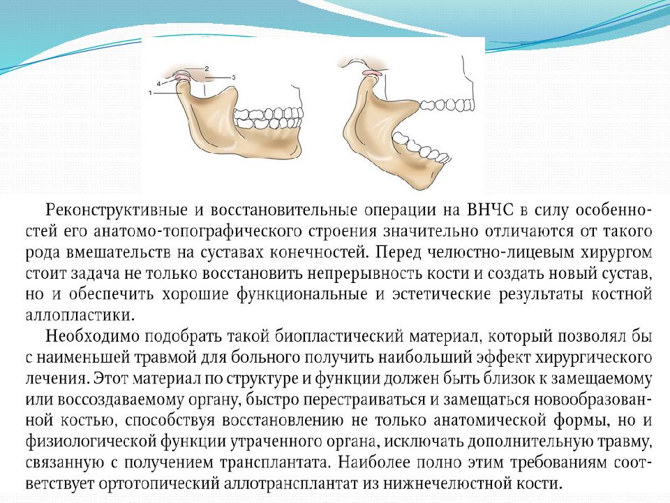 Вывих нижней челюсти карта вызова