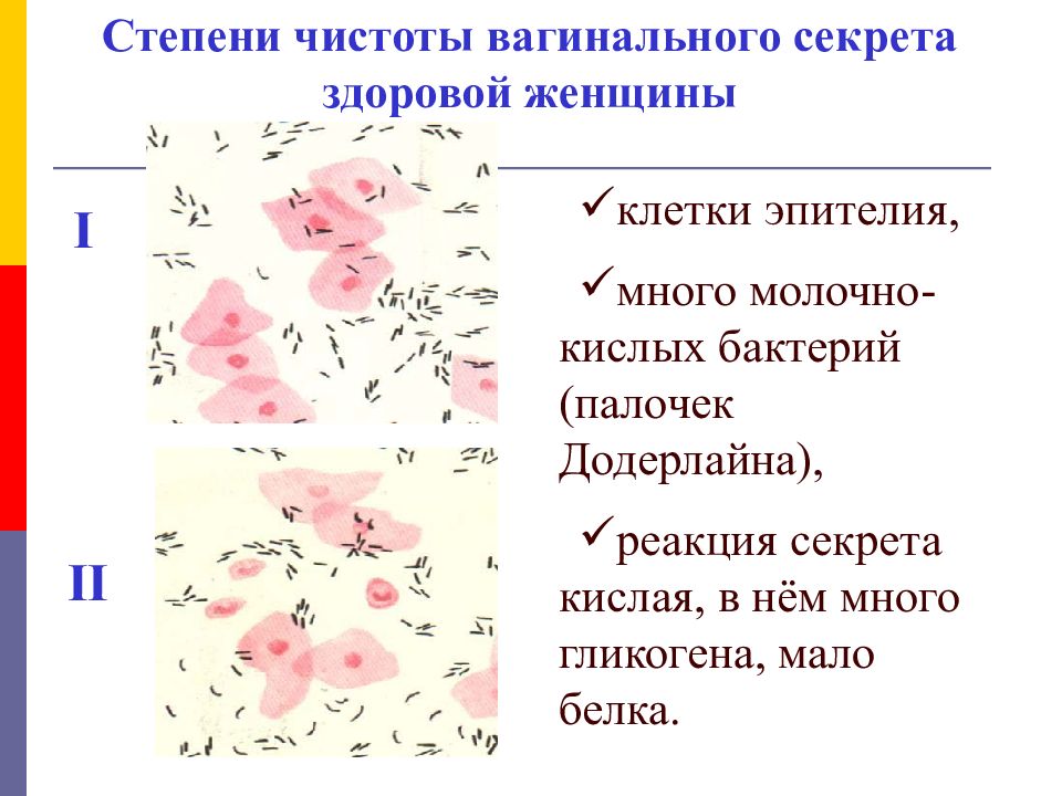 Эпителий в мазке у женщин. Степень чистоты вагинального мазка. Степень чистоты влагалищного мазка. 4 Степени чистоты влагалища. Мазок на степень чистоты влагалища.