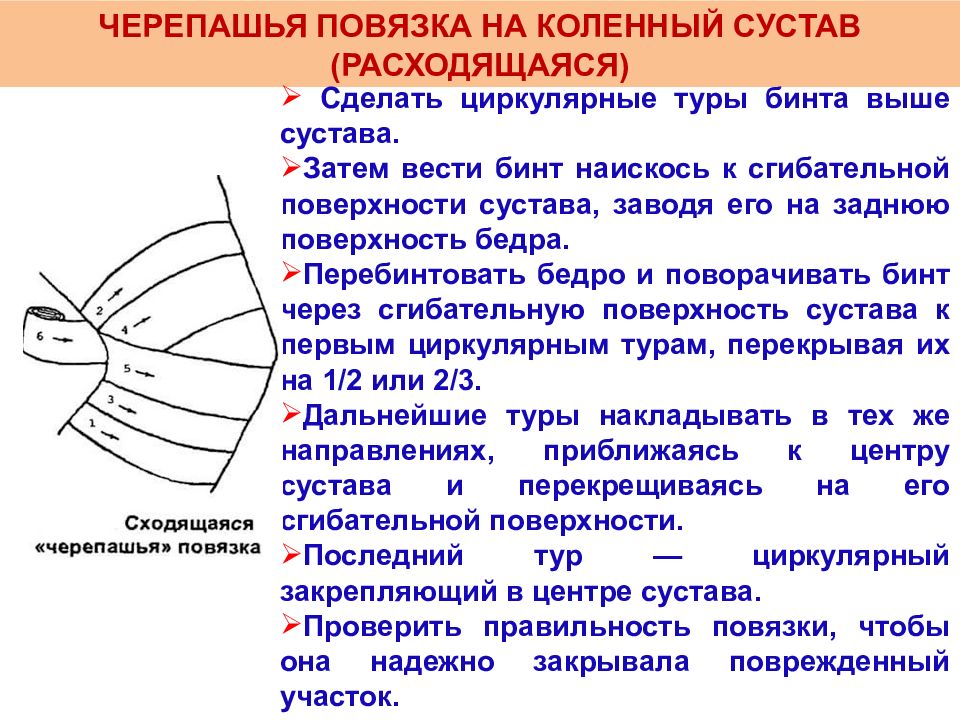 Спиралевидная повязка