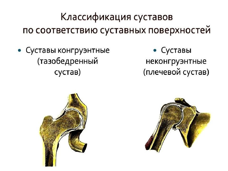 Сустав презентация. Презентация на тему болезни суставов. Суставные заболевания классификация. Суставы презентация 8 класс.