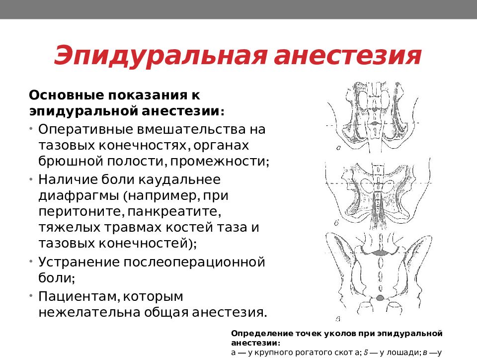 Уровни эпидуральной анестезии. Проведение эпидуральной анестезии. Эпидуральная анестезия показания. Показания и противопоказания к эпидуральной анестезии. Эпидуральная анестезия оперативные вмешательства.