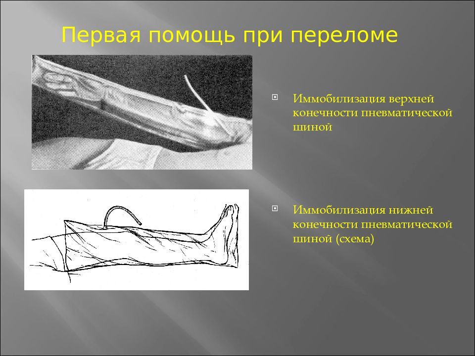 Карман риделя травматология рисунок