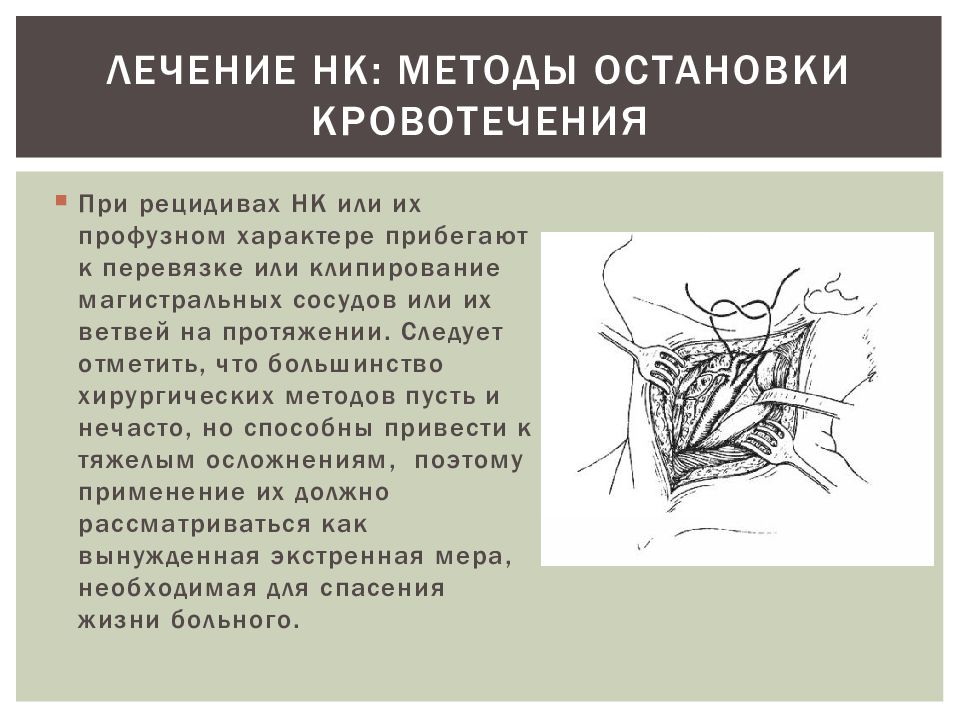 Носовое кровотечение презентация лор