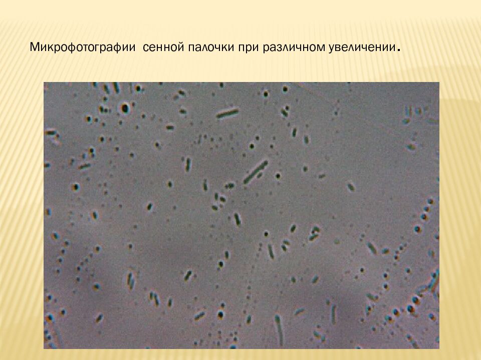 презентация: Тема: «ВИДЫ БАКТЕРИЙ»