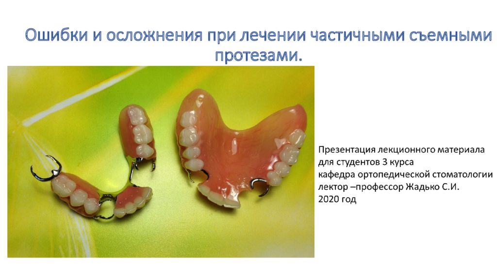 Пластиночные протезы презентация