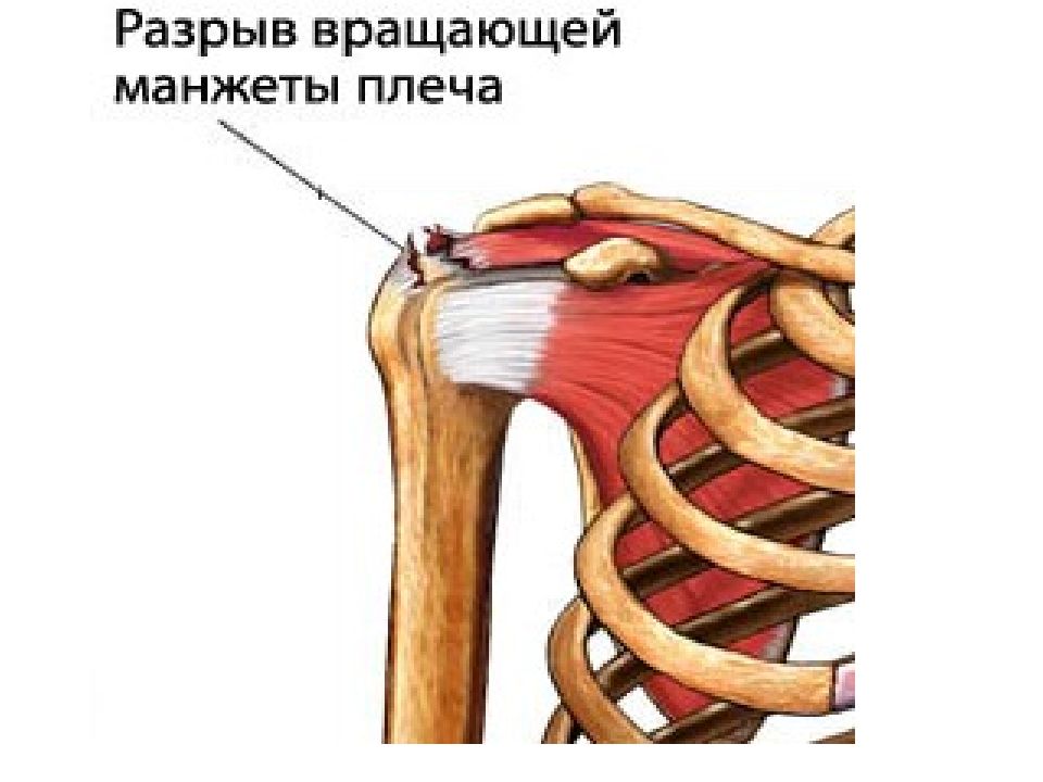 Rotator Cuff мышца