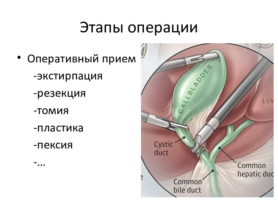 Хирургическая операция презентация