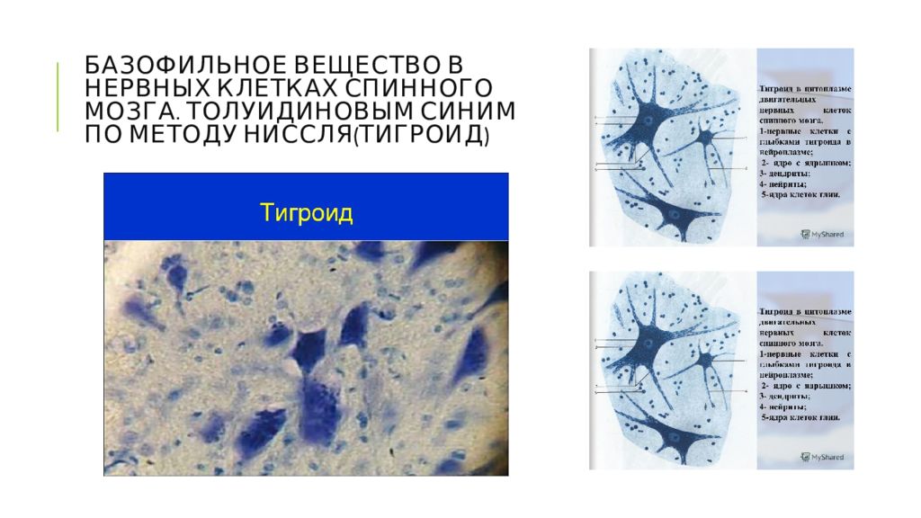 Вещество препарат. Тигроидное вещество в нервных клетках. Тигроид препарат гистология. Тигроид в нервных клетках спинного мозга препарат. Окраска по Нисслю гистология.