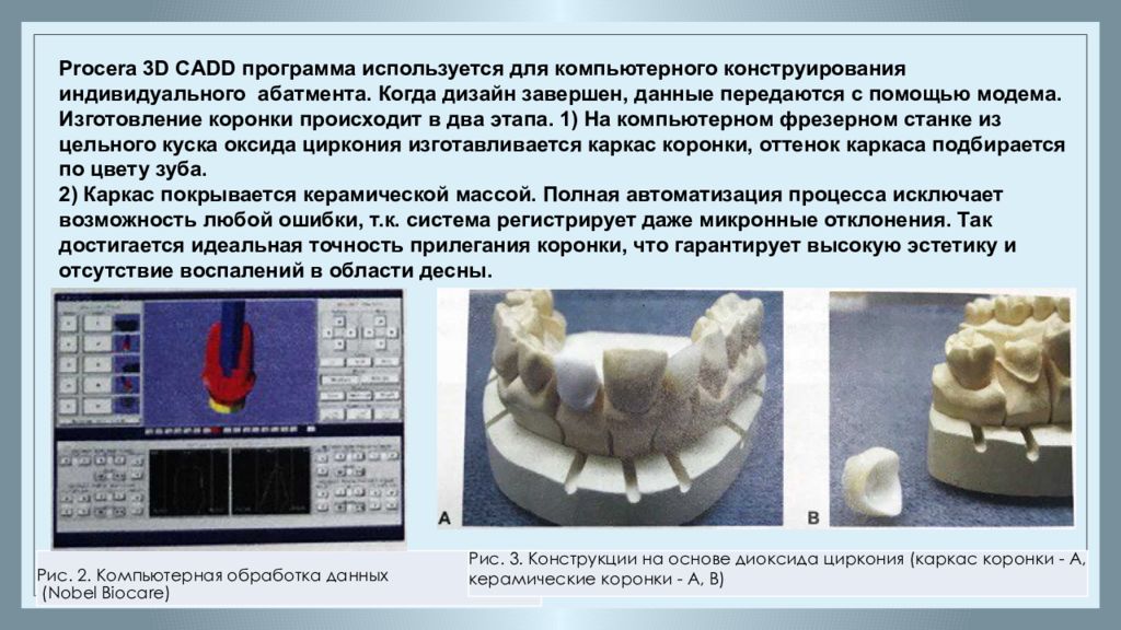 Cad cam технологии в ортопедической стоматологии презентация