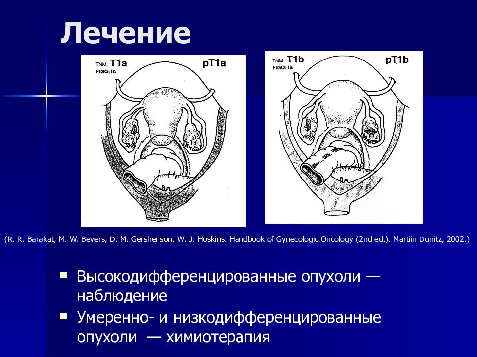 Злокачественные опухоли женских половых органов презентация