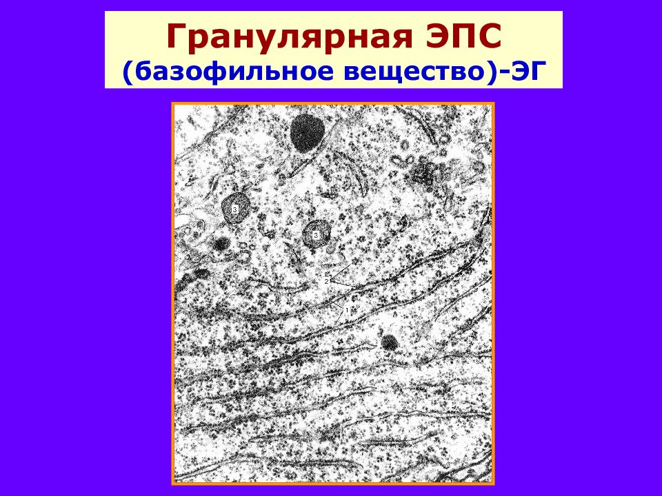 Гранулярная эпс. Электронограмма гранулярной ЭПС. Гранулярная и агранулярная ЭПС. Гранулярный эндоплазматический ретикулум. Морфология гранулярной ЭПС.