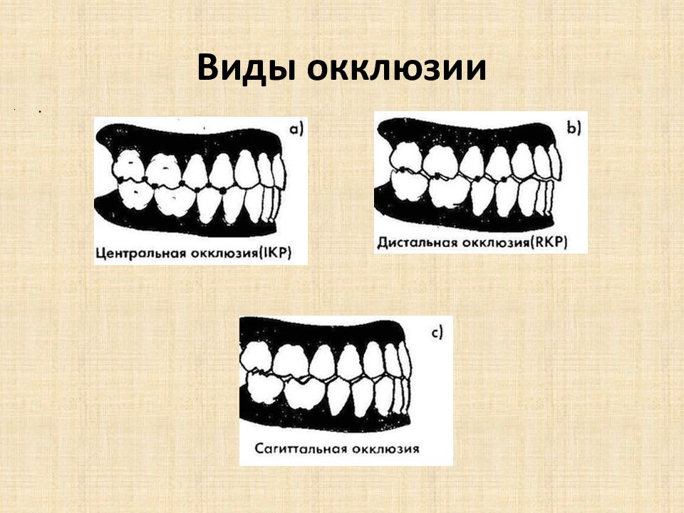 Центральной окклюзии зубной. Центральная окклюзия это в стоматологии. Артикуляция окклюзия и прикус зубов. Передняя окклюзия зубных рядов. Зубы в центральной окклюзии.