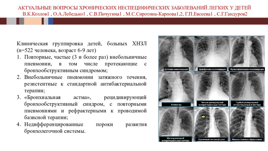 Неспецифические заболевания