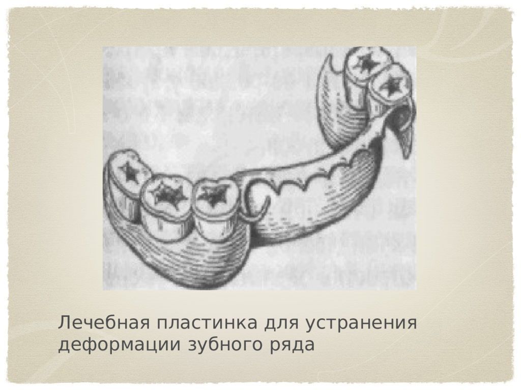 Основы окклюзионной диагностики презентация