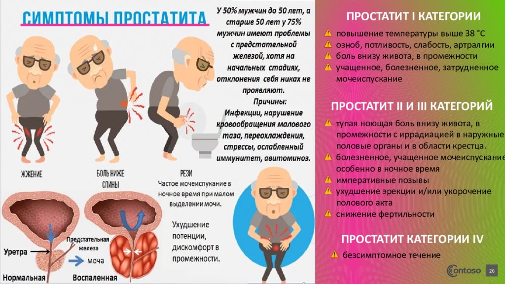 Простата у мужчин что это такое простыми словами фото и описание