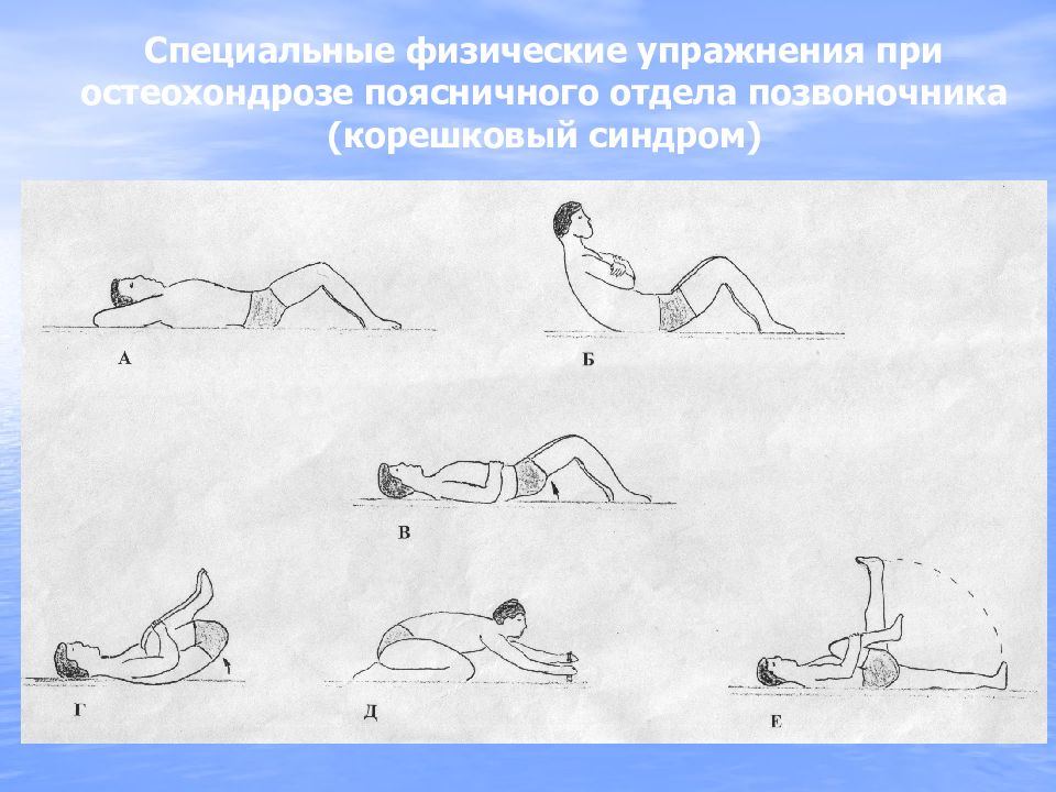 Карта вызова остеохондроз поясничного отдела позвоночника корешковый синдром