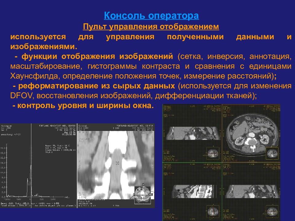 Презентация на тему компьютерная томография