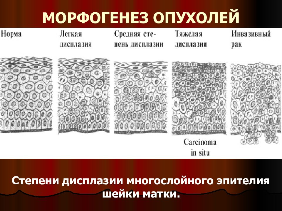 Морфогенез опухоли. Теории морфогенеза опухолей патанатомия. Морфогенез рисунок. Морфология и морфогенез опухолей патанатомия.