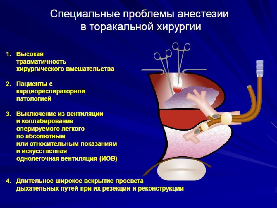 Торакальная хирургия презентация