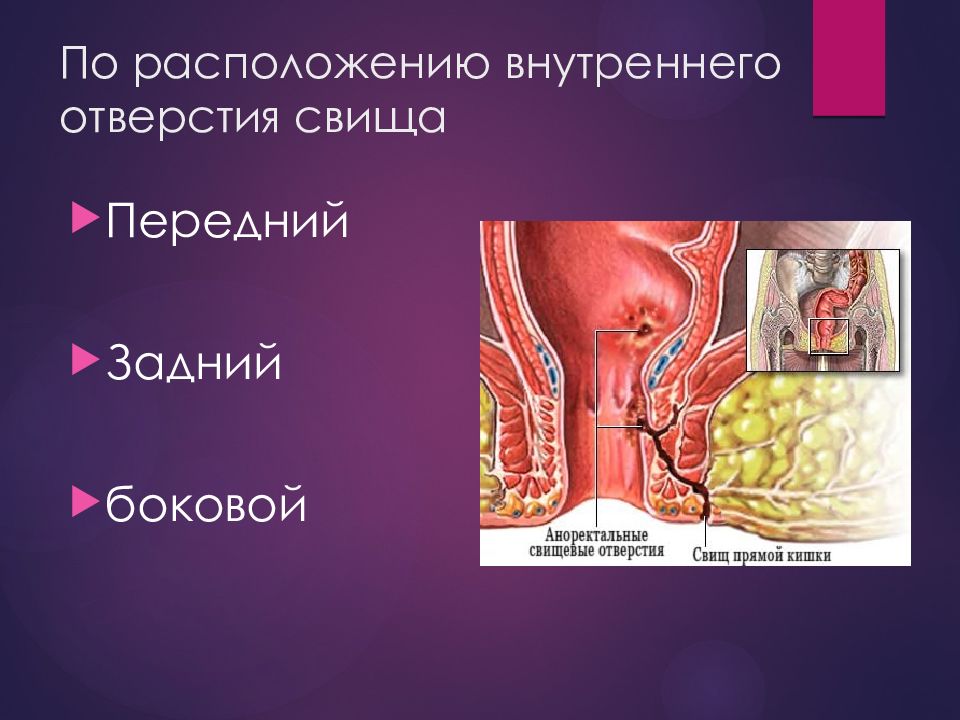 История проктологии презентация