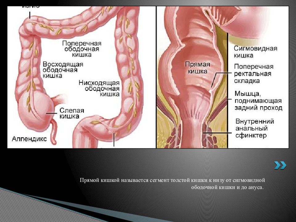 Рак ампулярного отдела. Сигмовидная ободочная кишка. Анатомия прямой кишки человека. Нисходящая сигмовидная кишка. Прямая и сигмовидная кишка.