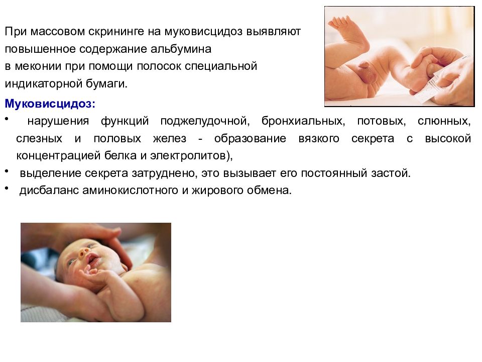 Заболевания новорожденных уход. Врожденные заболевания новорожденных. Наследственные и врожденные заболевания новорожденных. Врожденные заболевания новорожденных список. Врожденная патология у младенца.