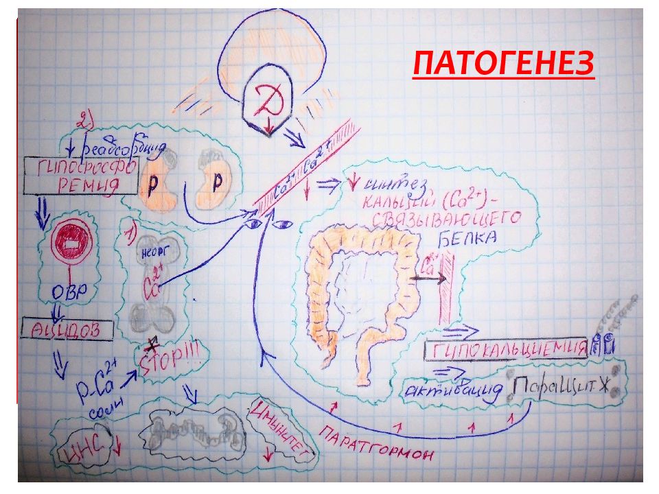 Схема патогенеза рахита