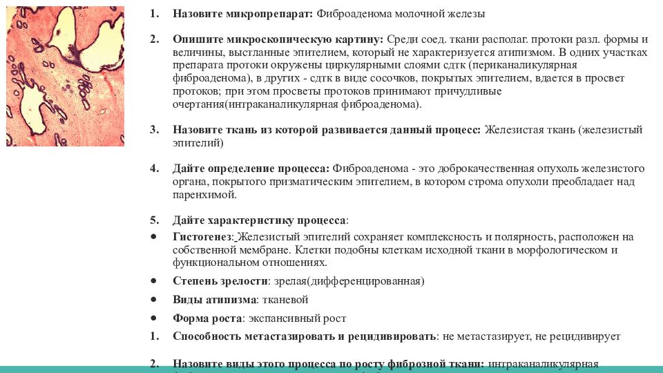 Фиброаденомы молочных желез. Микропрепараты патанатомия фиброаденома молочной железы. Фиброаденома молочной железы патанатомия интраканаликулярная. Фиброаденома молочной железы гистология. Фиброаденома молочной железы патанатомия препарат.