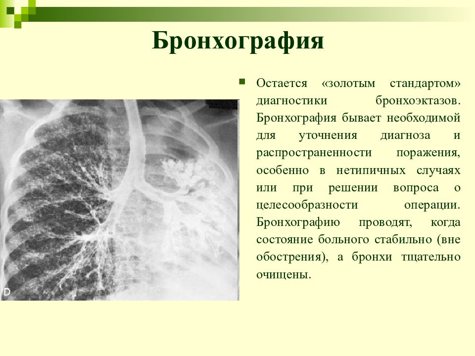 Бронхоэктатическая болезнь презентации