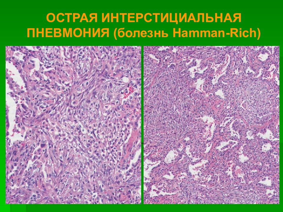 Патологическая анатомия картинки