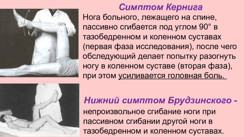 Симптом кернига. Синдром Кернига и Брудзинского. Симптом Кернига, симптомы Брудзинского. Положительный симптом Кернига. Положительные симптомы Кернига и Брудзинского.