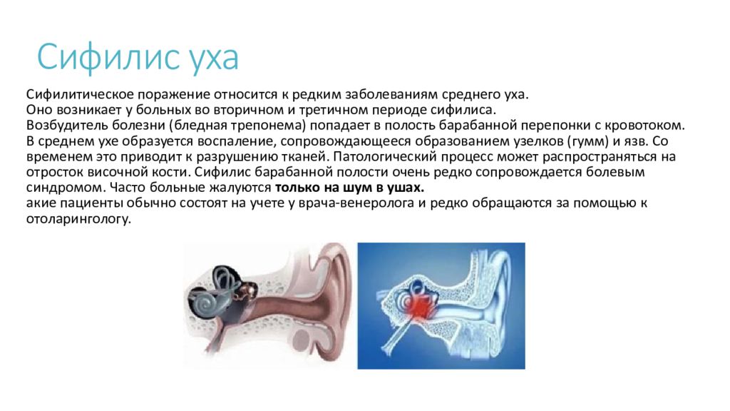 Нарушение среднего уха. Заболевания среднего уха. Болезни среднего уха презентация. Заболевания среднего уха презентация. Патологии среднего уха.