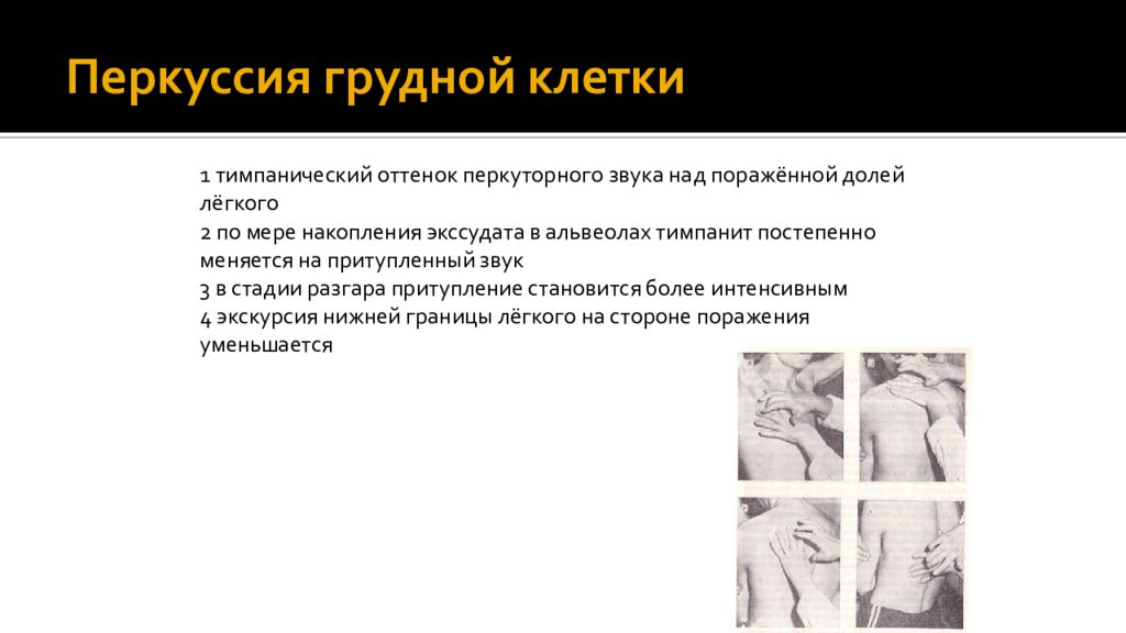 Тимпанит. Перкуссия грудной клетки. Перкусия грудного клетка. Перексия грудной клетки. Перкуторный звук грудной клетки.