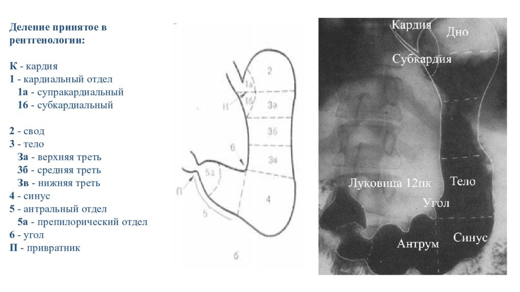 Где отдел. Кардиальный и антральный отдел желудка. Отделы желудка субкардиальный отдел. Кардиальный отдел желудка рентген. Препилорический отдел желудка.
