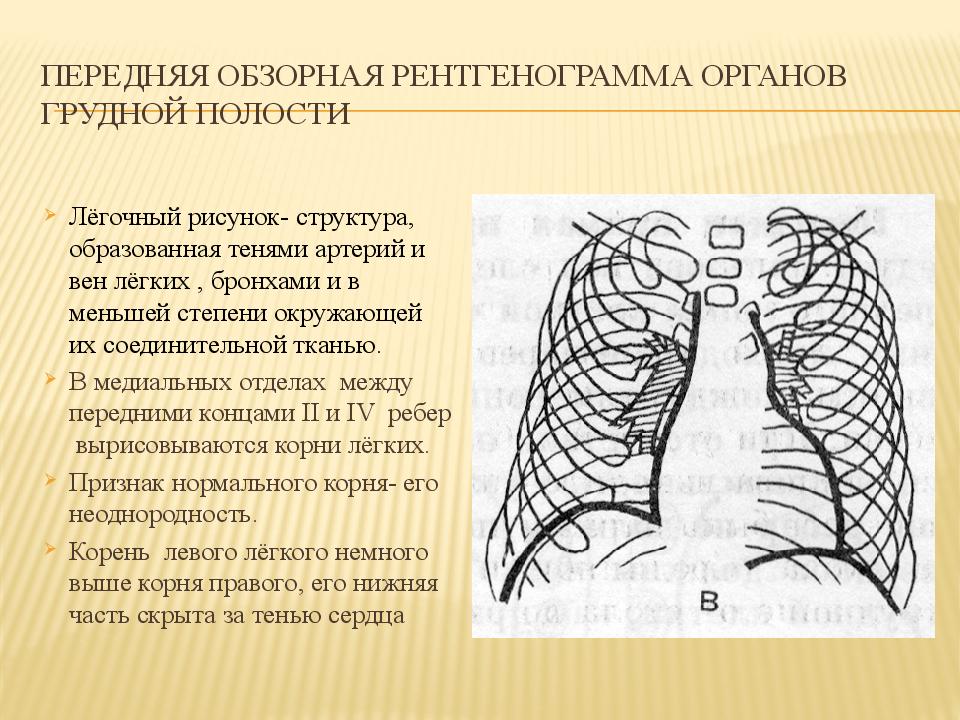 Что значит легочный рисунок. Легочный рисунок. Нормальный легочный рисунок. Легочный рисунок образован. Легочный рисунок избыточен.